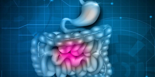 Post-Infectious IBS: Unraveling the Link Between Infections and Digestive Distress