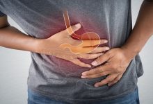 Irritable Bowel Syndrome (IBS): Understanding the Condition